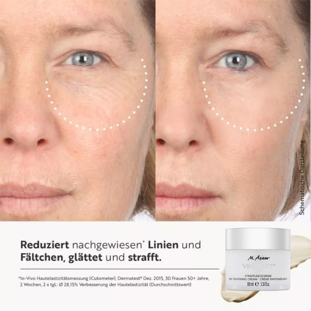Vorher-Nachher Vergleich mit VINOLIFT Straffungs-Set, das Linien und Fältchen glättet und strafft.