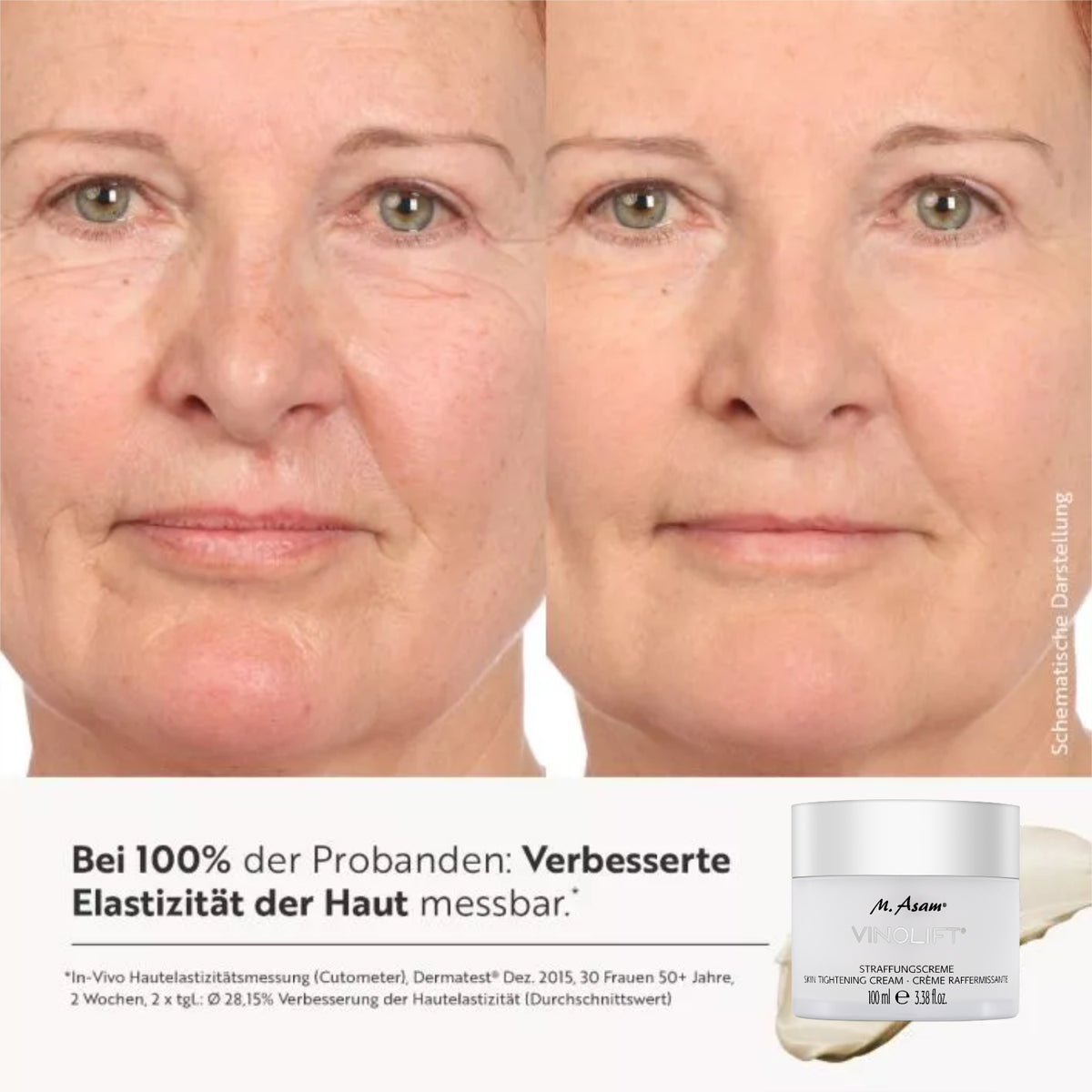 Vorher-Nachher-Bild einer Frau, die die Ergebnisse des M. Asam® VINOLIFT® Straffungs-Sets zeigt.