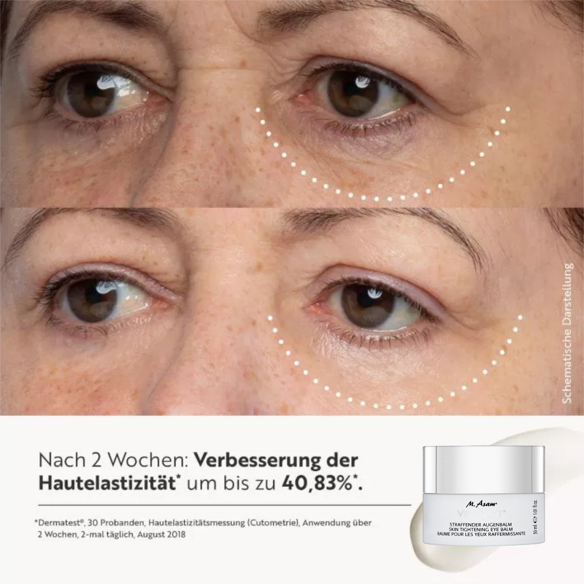 Vorher-Nachher-Nahaufnahme eines Augenbereichs mit Text 'Nach 2 Wochen: Verbesserung der Hautelastizität um bis zu 40,83%' und dem Produkt M. Asam VinoLift Augenbalsam.