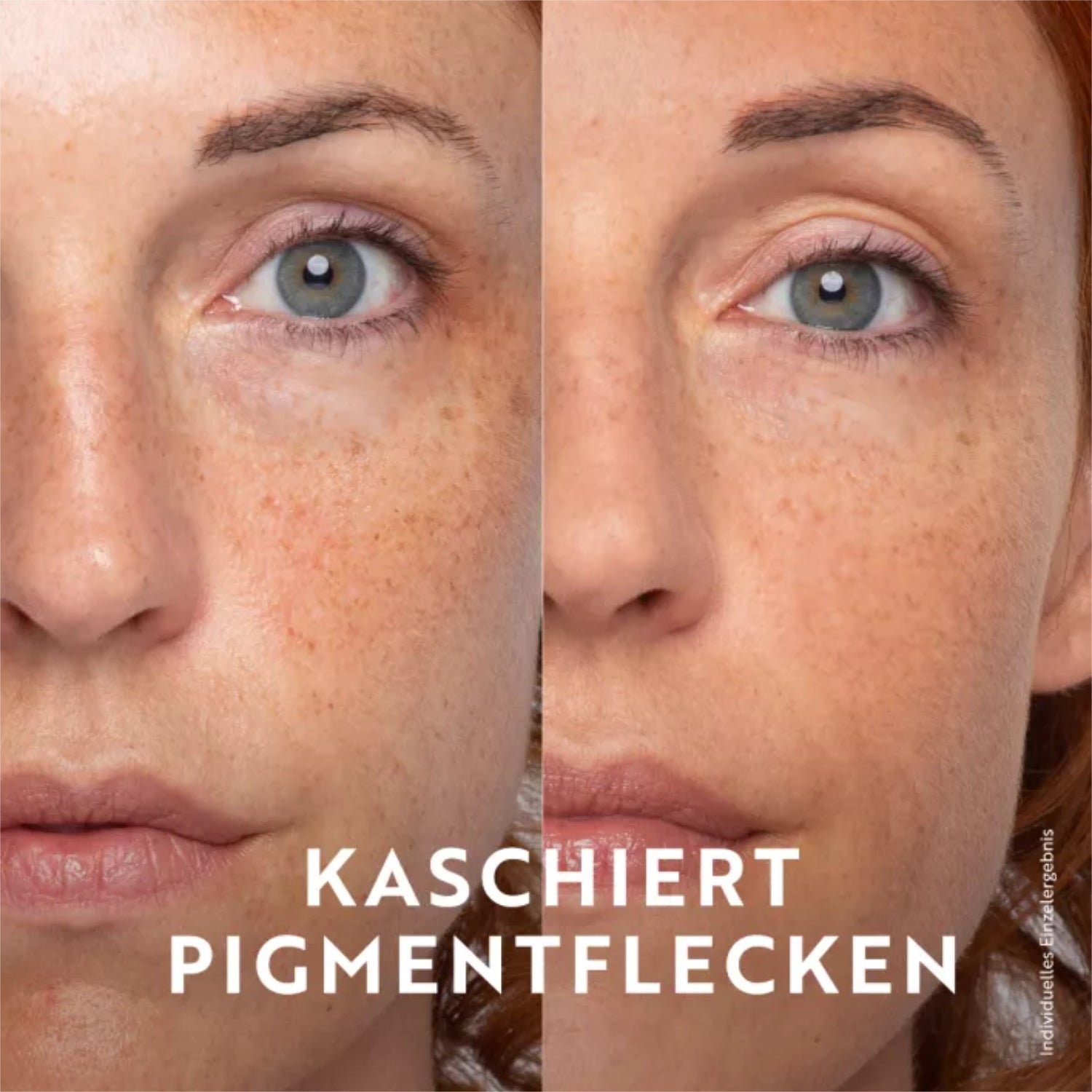 Vorher-nachher-Bild eines Gesichts mit und ohne Pigmentflecken, darunter der Text: "Kaschiert Pigmentflecken".