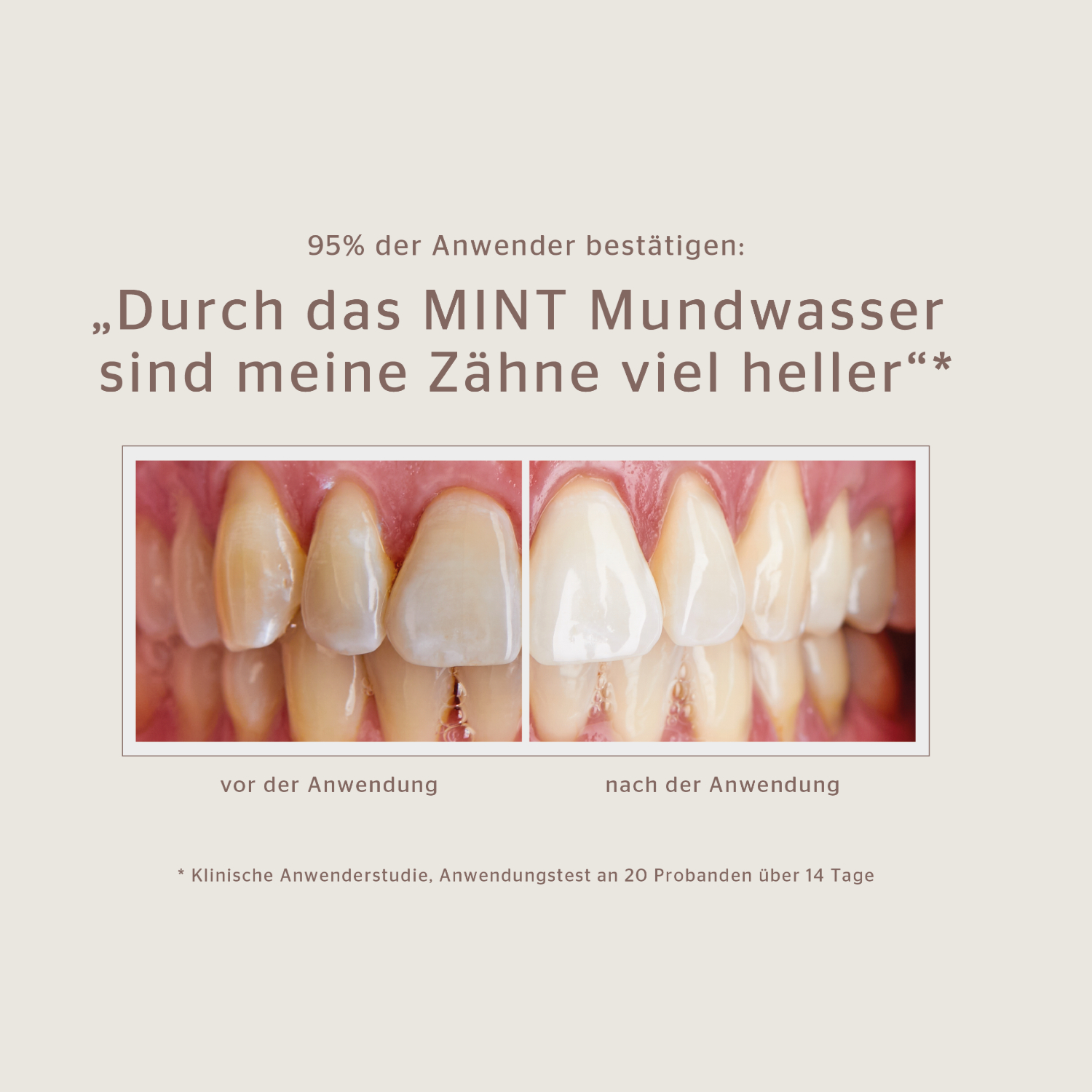 Vorher-nachher-Bilder von Zähnen mit der Aufschrift: „Durch das MINT Mundwasser sind meine Zähne viel heller“.