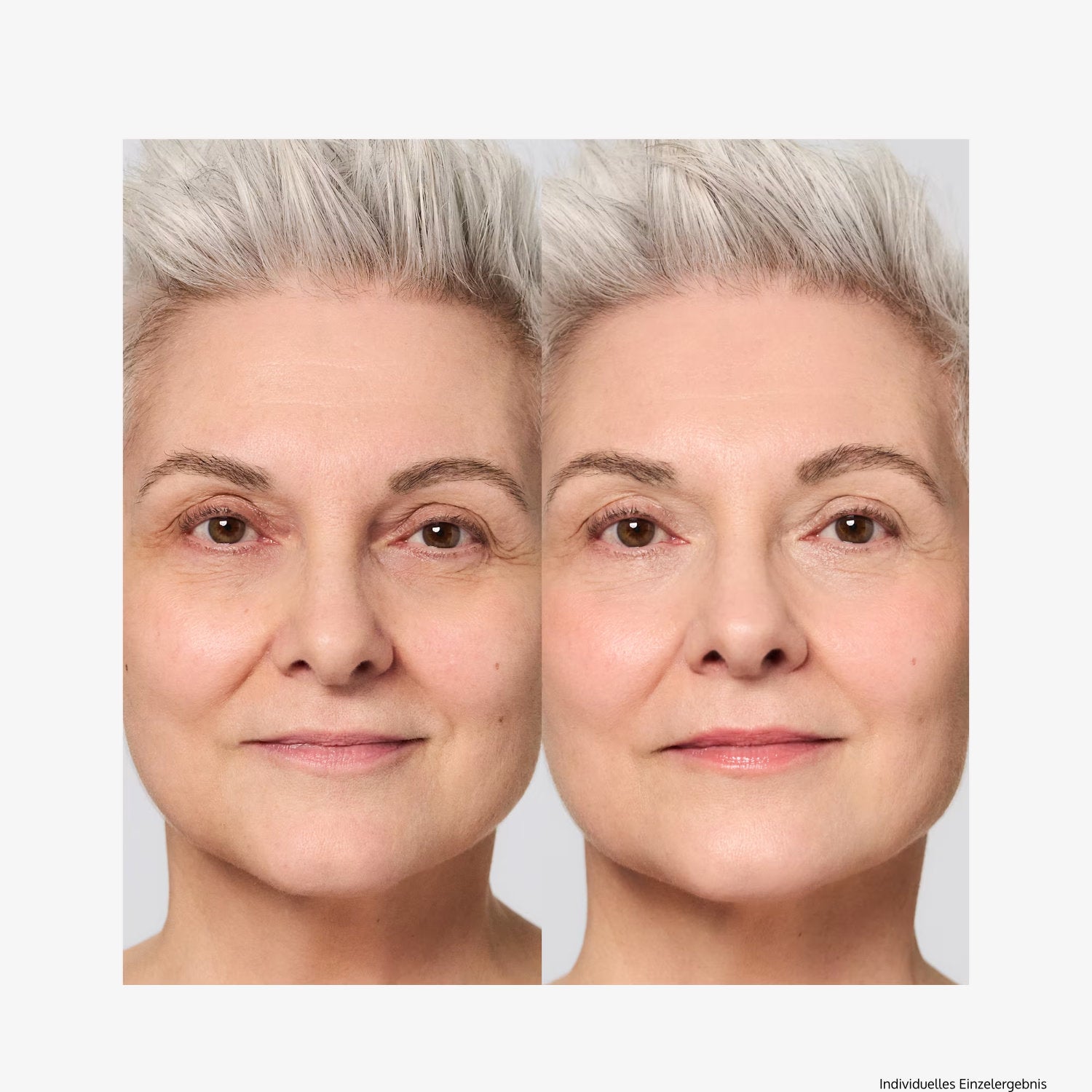 VINOLIFT Straffungscreme – 200 ml