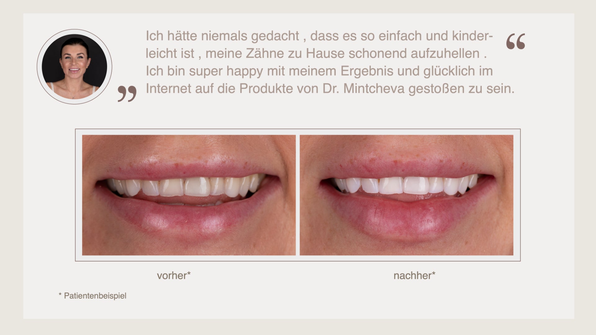 Vorher-nachher-Foto einer Zahnaufhellung mit einem Zitat einer zufriedenen Kundin oben im Bild.